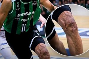 贾巴里·帕克膝盖近照：沟壑纵横 千疮百孔！曾遭两次ACL撕裂