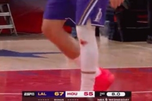 抹药了！东契奇左膝带伤作战 白色护膝已见红