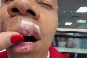 韦林顿妻子晒视频，嘴唇缝了15针且牙齿脱位